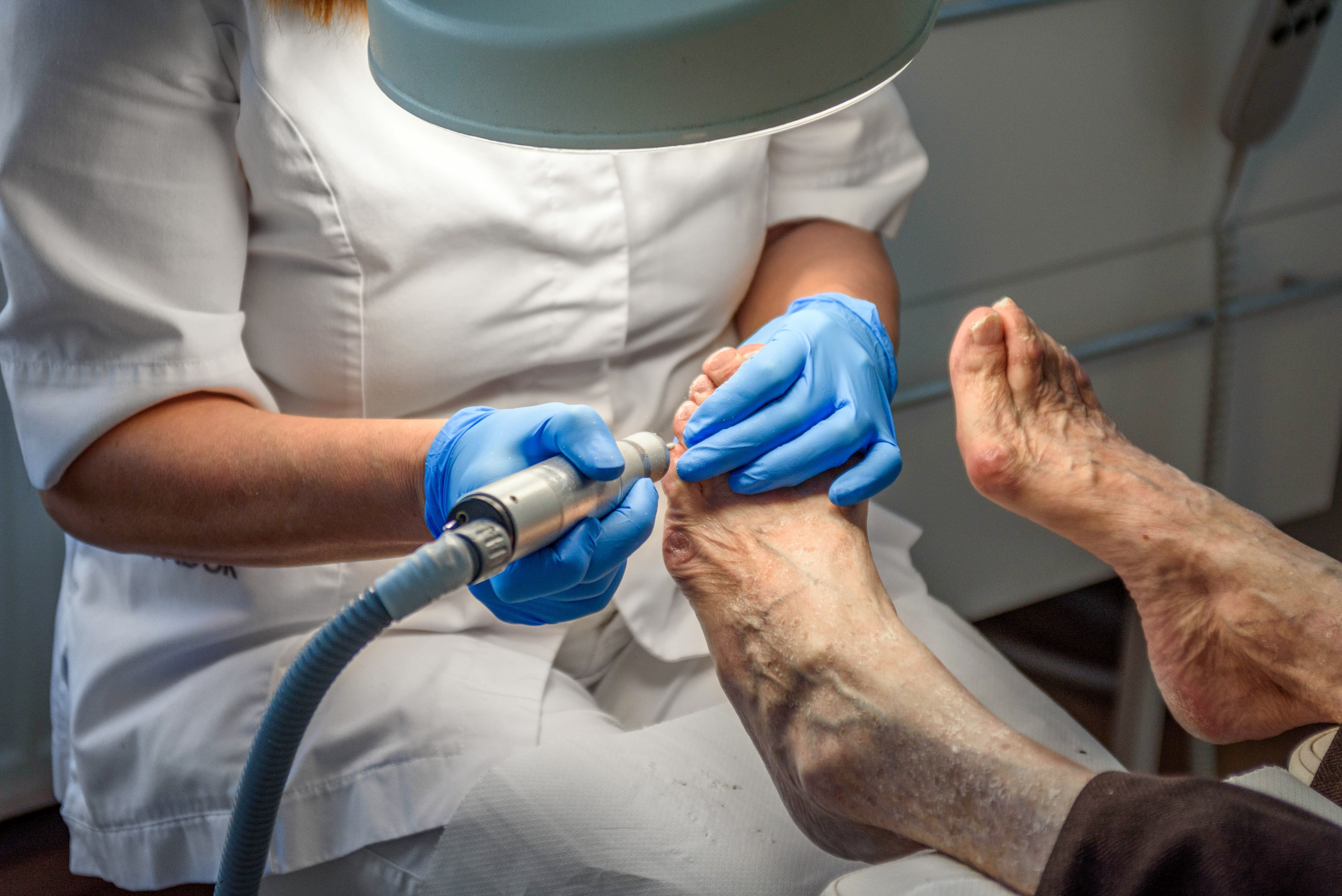 Profilaxis podal y pedicura médica